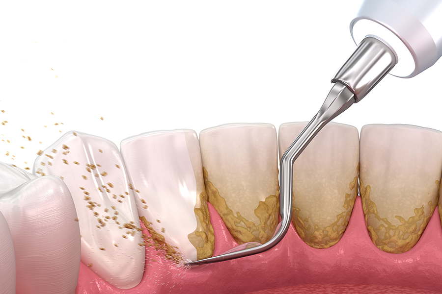 メンテナンスとスケーリング